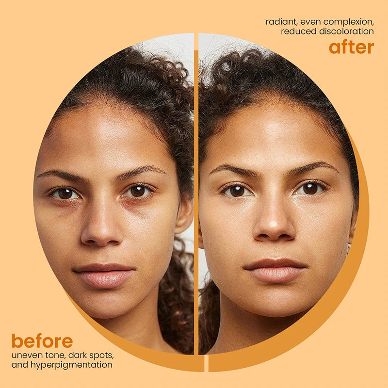 Turmeric Glow Soap Brightening Bars (3+ Bar Options)